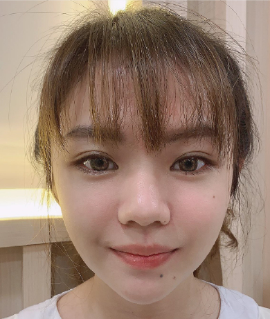 after
